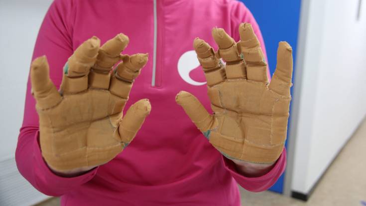 Zabalik dago Lemoan ospatuko dan andran pelota topaketarako izena emoteko epea